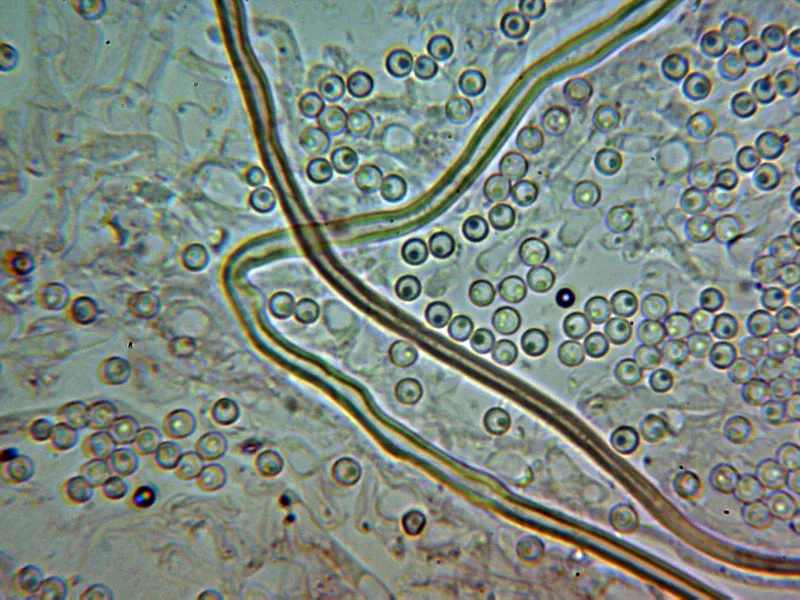 Apioperdon pyriforme 10 - Capilicio 2
